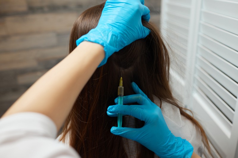 laser hair removal